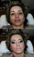 /album/fotogaleria/a205599013-3-estetica-unisex-diana-jpeg/